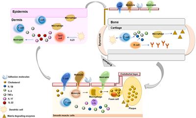Targeting Inflammation to Prevent Cardiovascular Disease in Chronic Rheumatic Diseases: Myth or Reality?